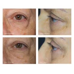 Dermalogica Awaken Peptide Eye Gel Sale