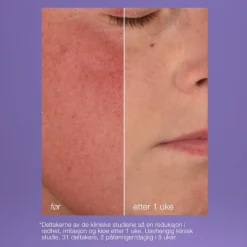 Dermalogica UltraCalming Stabilizing Repair Cream Sale