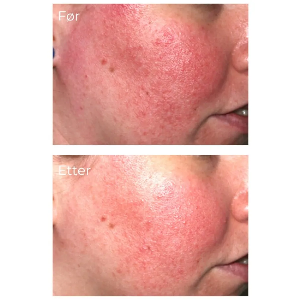 iS Clinical Pro-Heal Serum Advance+ 30 ml Discount