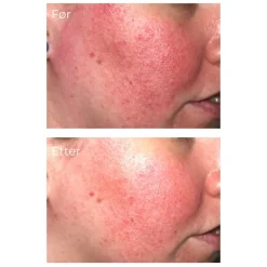 iS Clinical Pro-Heal Serum Advance+ 15 ml Outlet