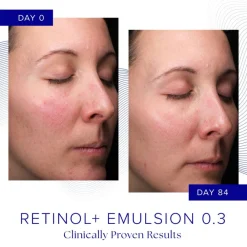 iS Clinical Retinol+ Emulsion 0.3 Online