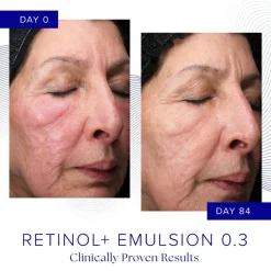 iS Clinical Retinol+ Emulsion 0.3 Online