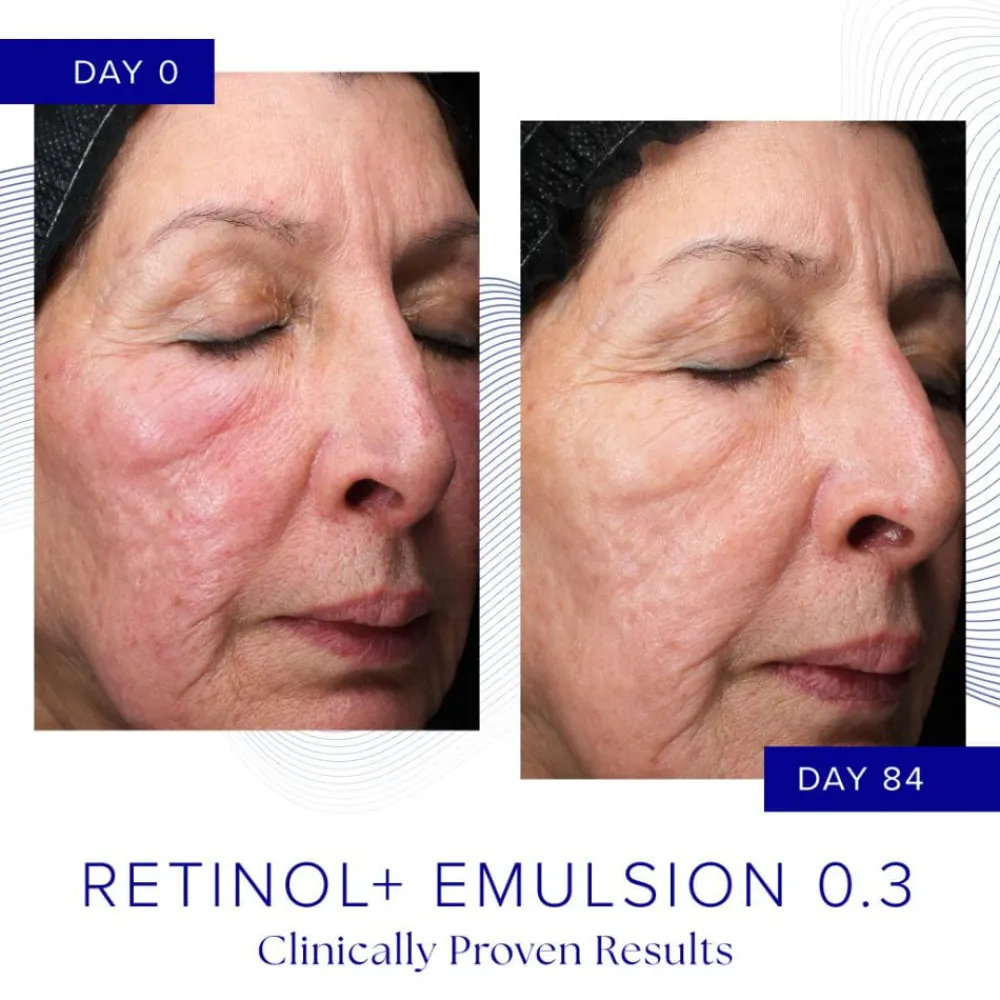 iS Clinical Retinol+ Emulsion 0.3 Online