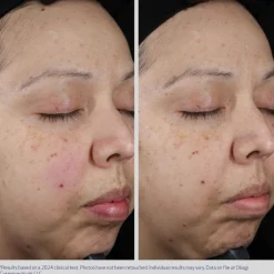 Obagi Medical Obagi Moisture Restore Best