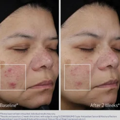 Obagi Medical Obagi Super Antioxidant Serum Discount