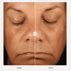 ZO Skin Health ZO Retinol Skin Brightener 1% Discount
