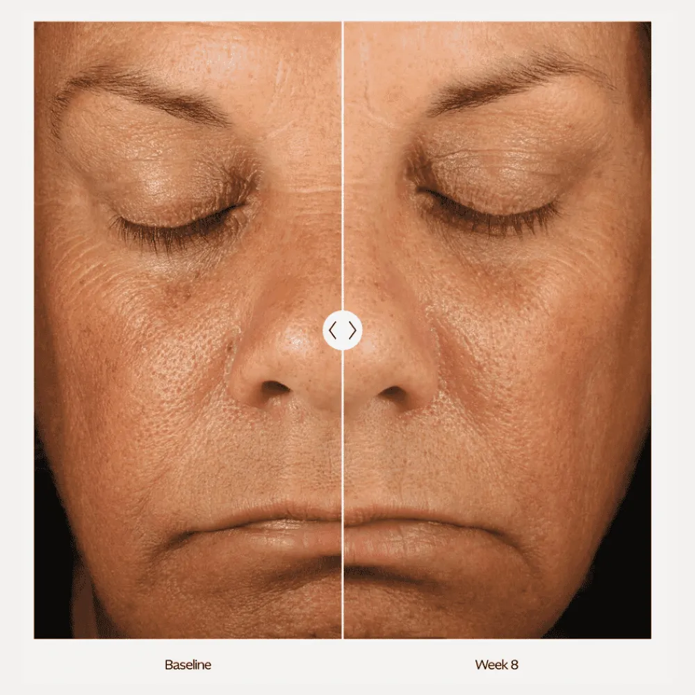 ZO Skin Health ZO Retinol Skin Brightener 1% Discount